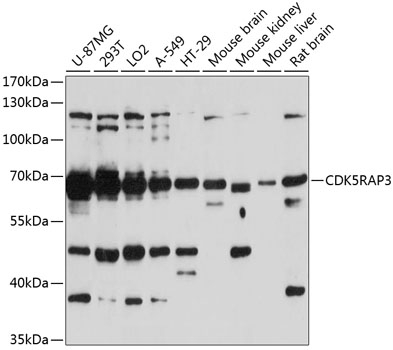 CDK5RAP3 Polyclonal Antibody