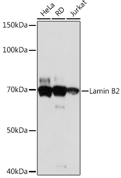 Lamin B2 Monoclonal Antibody [1S9M6]