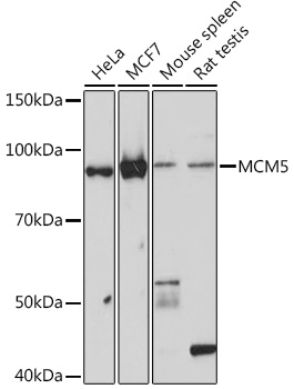 MCM5 Monoclonal Antibody [4P1Q5]