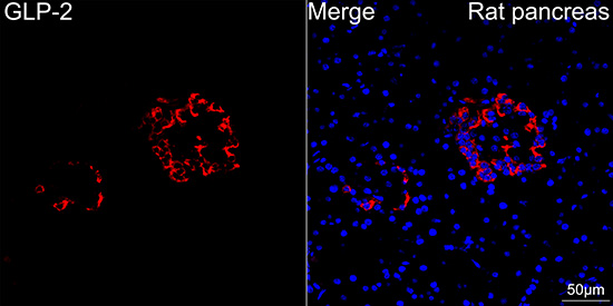 GLP-2 Monoclonal Antibody [3K3P5]