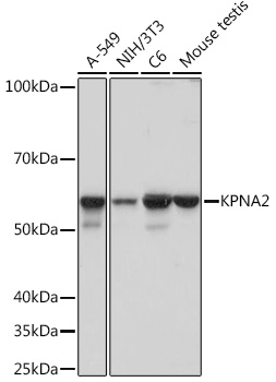 KPNA2 Monoclonal Antibody [9T3V8]