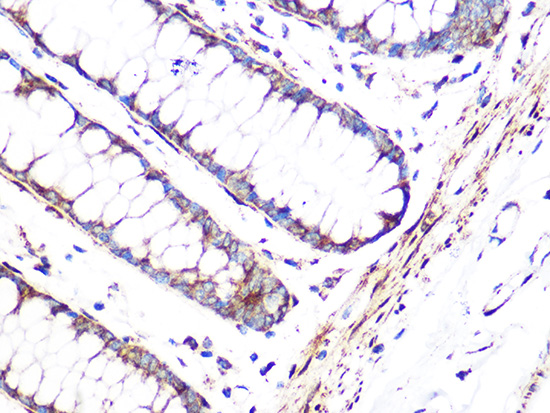 FHL1 Monoclonal Antibody [5F3G1]