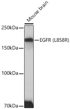 EGFR (L858R) Monoclonal Antibody [1J5C6]