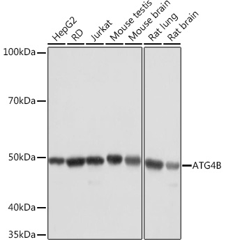 ATG4B Monoclonal Antibody [9H6M6]