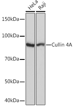 Cullin 4A Monoclonal Antibody [5P4M1]