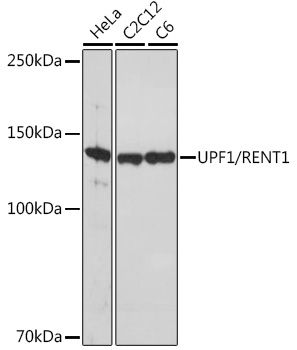 UPF1/RENT1 Monoclonal Antibody [5D5C4]