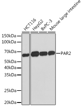 PAR2 Monoclonal Antibody [9X8E6]