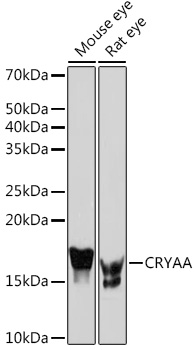 CRYAA Monoclonal Antibody [1T1F5]