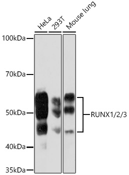 RUNX1/2/3 Monoclonal Antibody [6G5U2]
