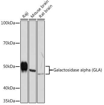 Galactosidase alpha (GLA) Monoclonal Antibody [7G8T9]