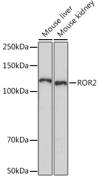 ROR2 Monoclonal Antibody [0B7X8]