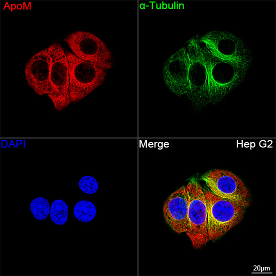 ApoM Monoclonal Antibody