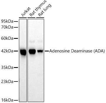 Adenosine Deaminase (ADA) Monoclonal Antibody [5R10B4]&nbsp;<img src="images/icon_newarrival.gif" alt="new" border="0">