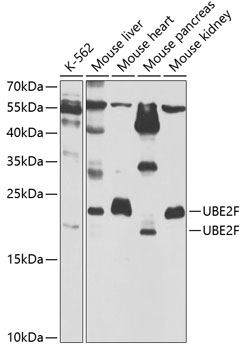 UBE2F Polyclonal Antibody
