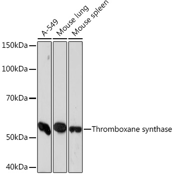 Thromboxane synthase Monoclonal Antibody [6B7Z7]