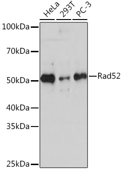 Rad52 Monoclonal Antibody [7H5K0]