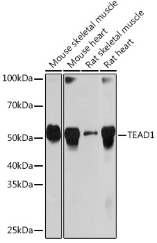TEAD1 Monoclonal Antibody [2E7N10]