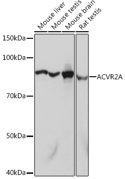 ACVR2A Monoclonal Antibody [1K1J10]