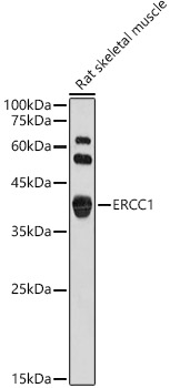 ERCC1 Polyclonal Antibody