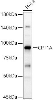 CPT1A Polyclonal Antibody