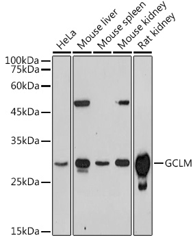GCLM Polyclonal Antibody