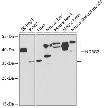 NDRG2 Polyclonal Antibody