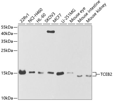 TCEB2 Polyclonal Antibody