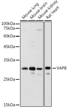 VAPB Polyclonal Antibody