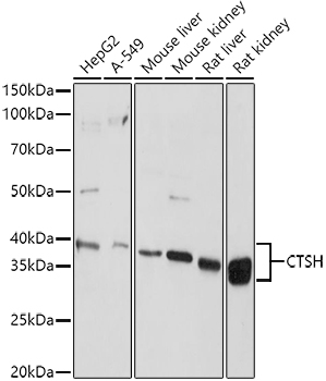 CTSH Polyclonal Antibody