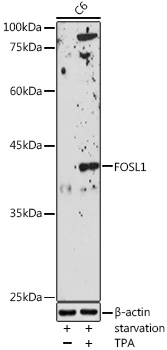 FOSL1 Polyclonal Antibody