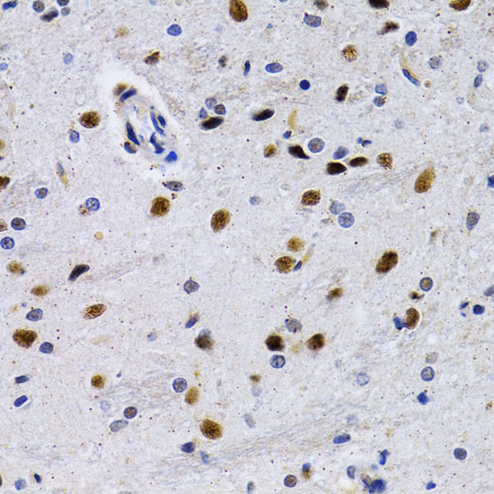 ID3 Polyclonal Antibody