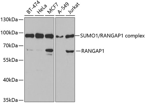 RanGAP1 Polyclonal Antibody