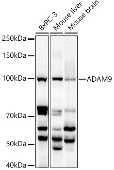 ADAM9 Polyclonal Antibody&nbsp;<img src="images/icon_newarrival.gif" alt="new" border="0">