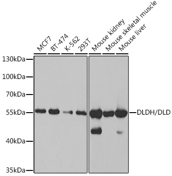 DLDH/DLD Polyclonal Antibody
