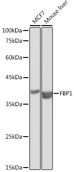 FBP1 Polyclonal Antibody