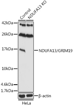 NDUFA13/GRIM19 Polyclonal Antibody&nbsp;<img src="images/icon_newarrival.gif" alt="new" border="0">