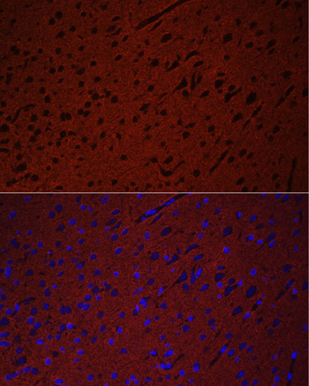 STXBP1 Polyclonal Antibody