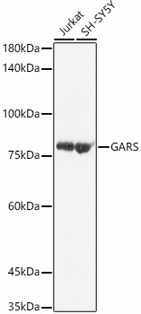 GARS Polyclonal Antibody