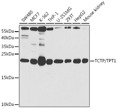 TCTP/TPT1 Polyclonal Antibody