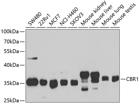 CBR1 Polyclonal Antibody