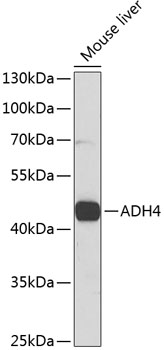 ADH4 Polyclonal Antibody&nbsp;<img src="images/icon_newarrival.gif" alt="new" border="0">