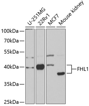 FHL1 Polyclonal Antibody