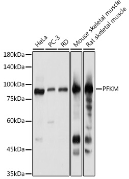 PFKM Polyclonal Antibody