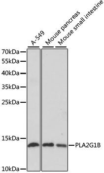 PLA2G1B Polyclonal Antibody