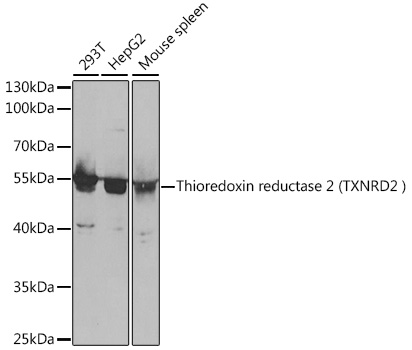Thioredoxin reductase 2 (TXNRD2 ) Polyclonal Antibody