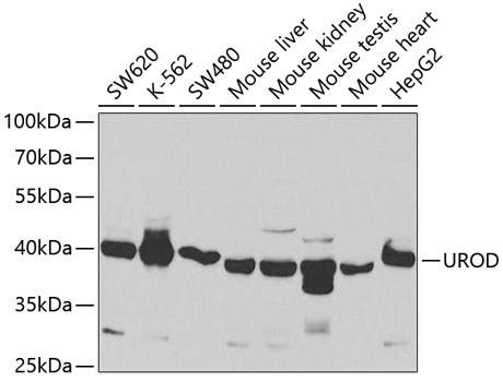 UROD Polyclonal Antibody