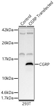CGRP Polyclonal Antibody