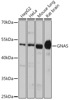 GNAS Polyclonal Antibody