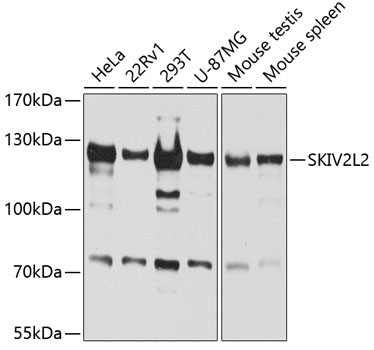 SKIV2L2 Polyclonal Antibody