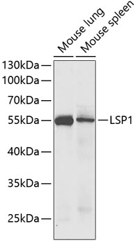 LSP1 Polyclonal Antibody